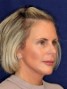 a lady with blond chin-length hair