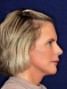 a lady with blond chin-length hair