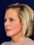 a lady with blond chin-length hair