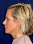 a lady with blond chin-length hair